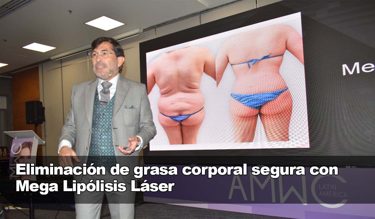 Eliminación segura y eficaz de la grasa corporal con Mega Lipólisis Láser